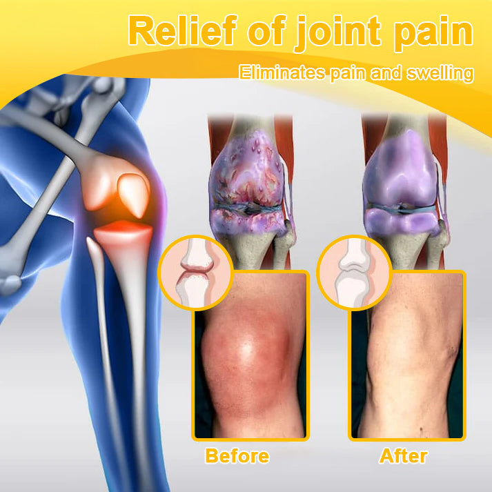 🎁Flash Sale - ODALIT™ Botulinum Toxin & Bee Venom Pain-Relief Bone Healing Cream