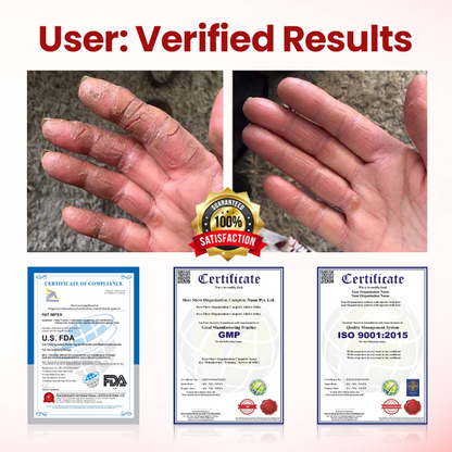 ODEIUN® VitaGluco Diabetic Care Cream