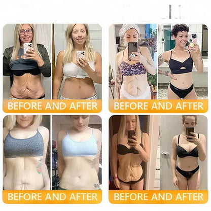 ODEIUN® 𝖡𝖾𝖾 𝗏𝖾𝗇𝗈𝗆 𝖲𝗄𝗂𝗇 𝖱𝖾𝗌𝗍𝗈𝗋𝖺𝗍𝗂𝗈𝗇 𝖢𝗋𝖾𝖺𝗆✨Made and Shipped from USA