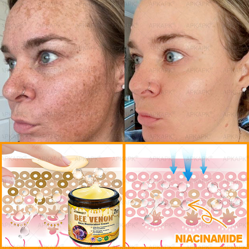 ODEIUN® 𝖡𝖾𝖾 𝗏𝖾𝗇𝗈𝗆 𝖲𝗄𝗂𝗇 𝖱𝖾𝗌𝗍𝗈𝗋𝖺𝗍𝗂𝗈𝗇 𝖢𝗋𝖾𝖺𝗆✨Made and Shipped from USA