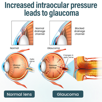 🔥Timilk® OptiFusion Nano Eye Drops Serum —Nano Technology Restores Clear Vision,  No Glasses, No Surgery