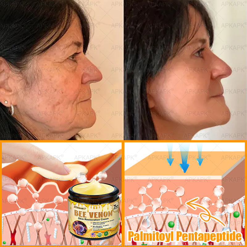 ODEIUN® 𝖡𝖾𝖾 𝗏𝖾𝗇𝗈𝗆 𝖲𝗄𝗂𝗇 𝖱𝖾𝗌𝗍𝗈𝗋𝖺𝗍𝗂𝗈𝗇 𝖢𝗋𝖾𝖺𝗆✨Made and Shipped from USA