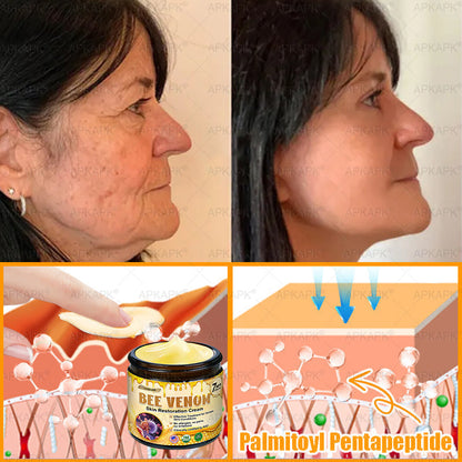 ODEIUN® 𝖡𝖾𝖾 𝗏𝖾𝗇𝗈𝗆 𝖲𝗄𝗂𝗇 𝖱𝖾𝗌𝗍𝗈𝗋𝖺𝗍𝗂𝗈𝗇 𝖢𝗋𝖾𝖺𝗆✨Made and Shipped from USA