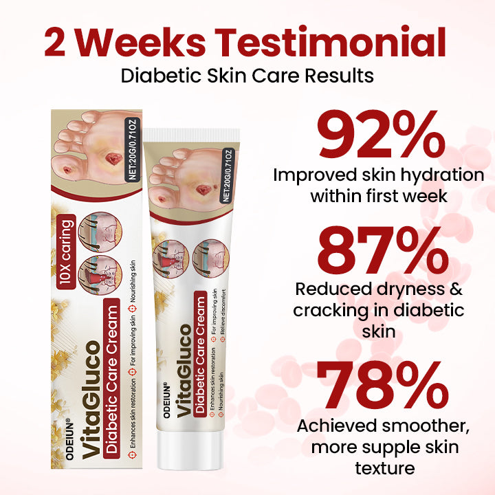 ODEIUN® VitaGluco Diabetic Care Cream