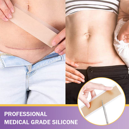 ✅Official Store |NEGUSY® Hyaluronic Acid Nano Microneedle Repair Tape🏉❤️