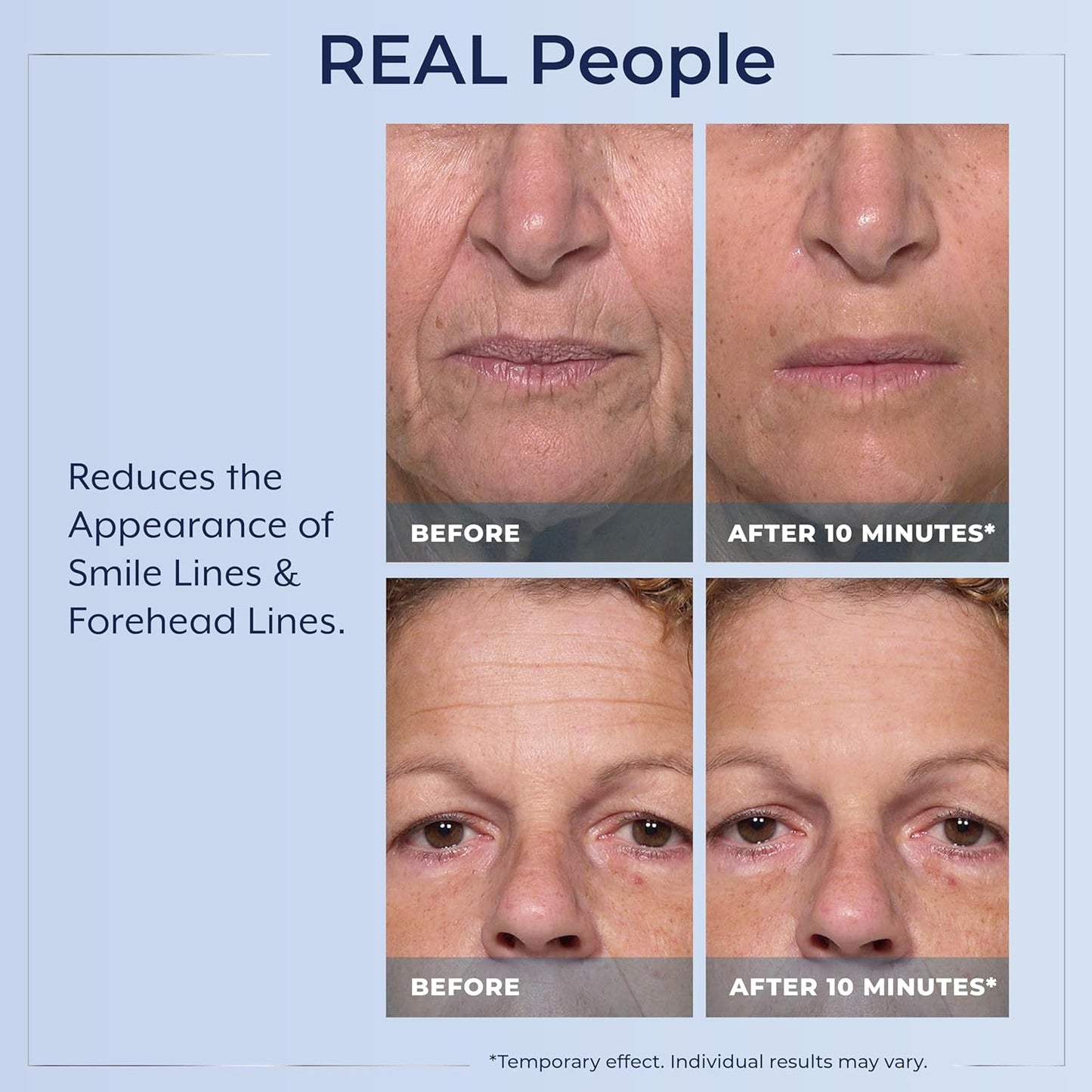 🌟 Prexdren®  Rapid Reduction Eye Serum — Instantly reduces eye bags, wrinkles, and dark circles