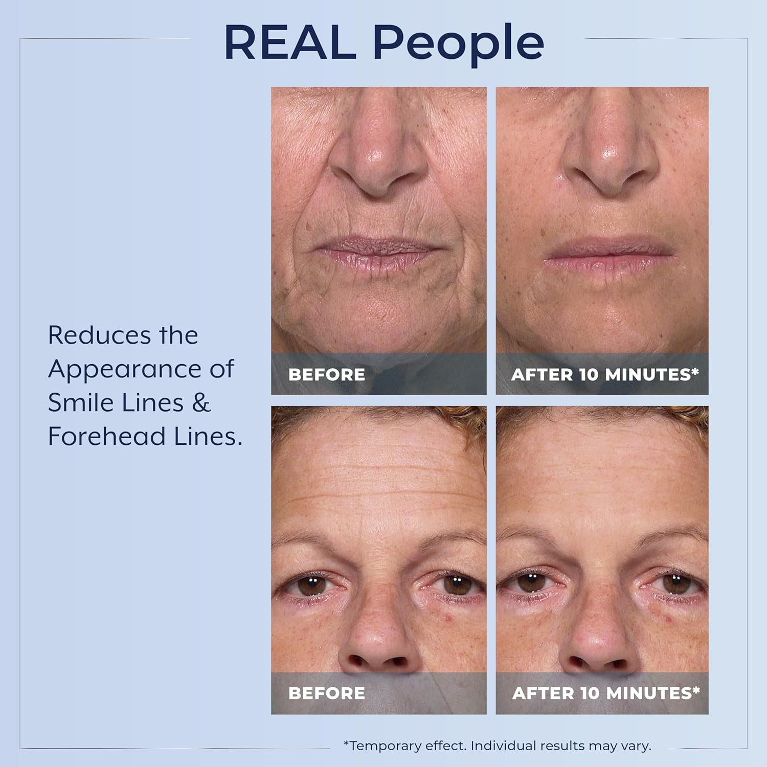 🌟 Prexdren®  Rapid Reduction Eye Serum — Instantly reduces eye bags, wrinkles, and dark circles
