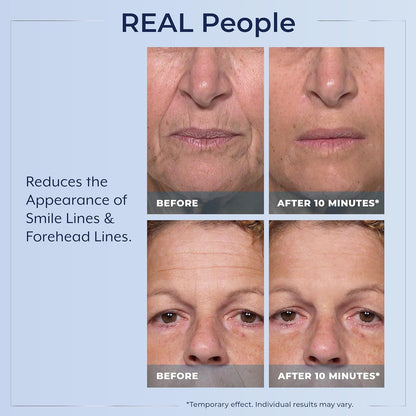 🌟 Prexdren®  Rapid Reduction Eye Serum — Instantly reduces eye bags, wrinkles, and dark circles