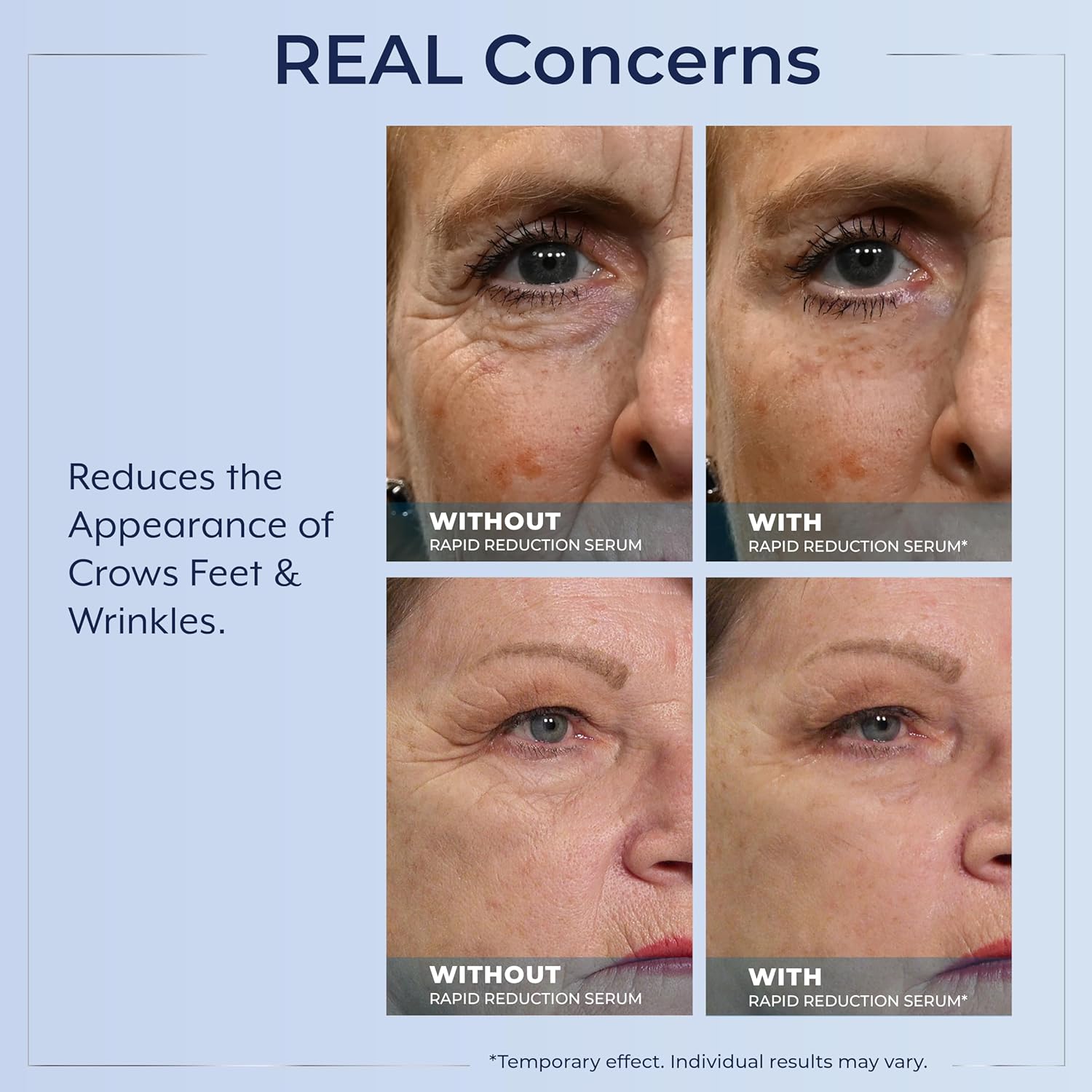 🌟 Prexdren®  Rapid Reduction Eye Serum — Instantly reduces eye bags, wrinkles, and dark circles
