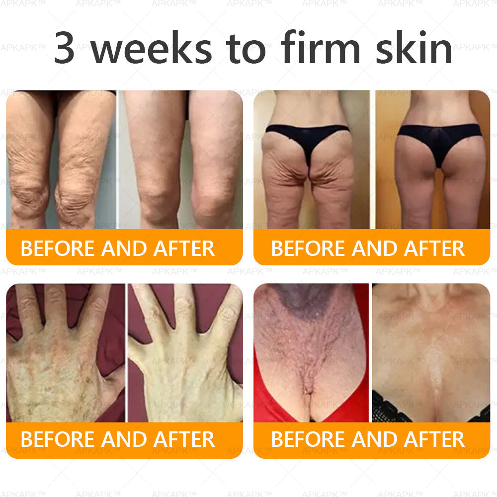 Made and Shipped from U.S. 🫧𝖠𝖯𝖪𝖠𝖯𝖪® 𝖡𝖾𝖾 𝗏𝖾𝗇𝗈𝗆 𝖲𝗄𝗂𝗇 𝖱𝖾𝗌𝗍𝗈𝗋𝖺𝗍𝗂𝗈𝗇 𝖢𝗋𝖾𝖺𝗆