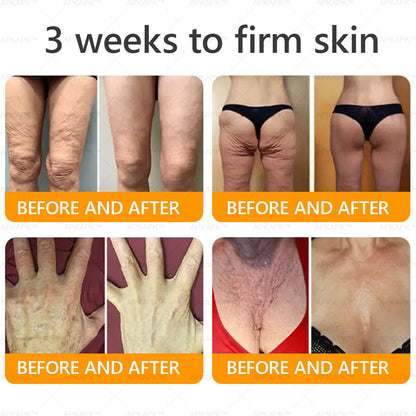 Made and Shipped from U.S. 🫧𝖠𝖯𝖪𝖠𝖯𝖪® 𝖡𝖾𝖾 𝗏𝖾𝗇𝗈𝗆 𝖲𝗄𝗂𝗇 𝖱𝖾𝗌𝗍𝗈𝗋𝖺𝗍𝗂𝗈𝗇 𝖢𝗋𝖾𝖺𝗆