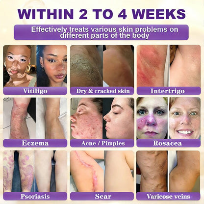 Made and Shipped from the US ODALIT® Biotin 10-in-1 Skin Repair Cream — Last Day of Sale: 75% Off