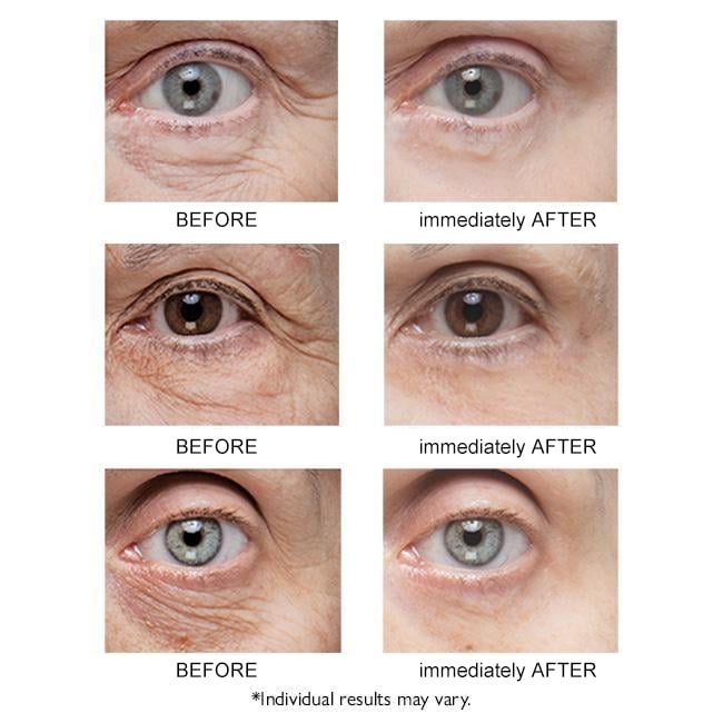 🔥Last Day 49% OFF🔥 Instant Eye Lift Firming Cream💕