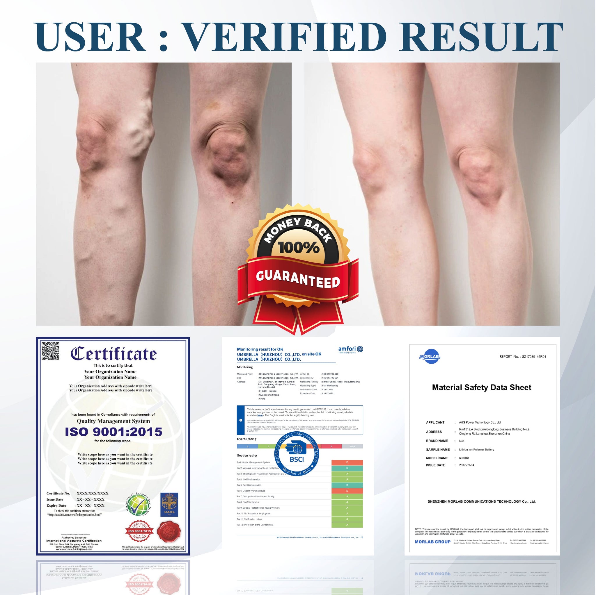 ODEIUN® Black Cumin Edema Detox Herbal Cream