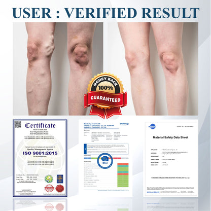 ODEIUN® Black Cumin Edema Detox Herbal Cream