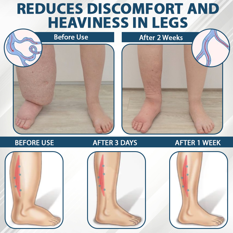 ODEIUN® Black Cumin Edema Detox Herbal Cream