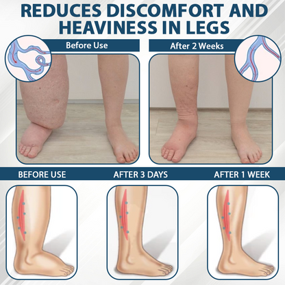 ODEIUN® Black Cumin Edema Detox Herbal Cream