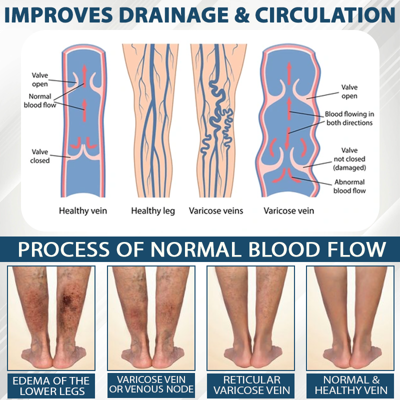ODEIUN® Black Cumin Edema Detox Herbal Cream