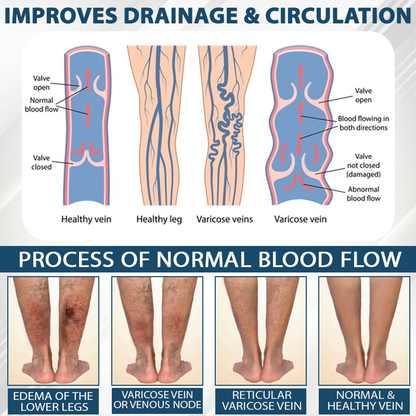 ODEIUN® Black Cumin Edema Detox Herbal Cream