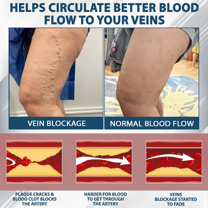 ODEIUN® Black Cumin Edema Detox Herbal Cream