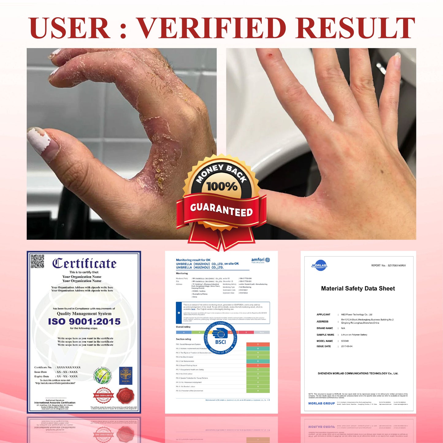 ODEIUN® GlucoseGuard Skin Rescue Cream