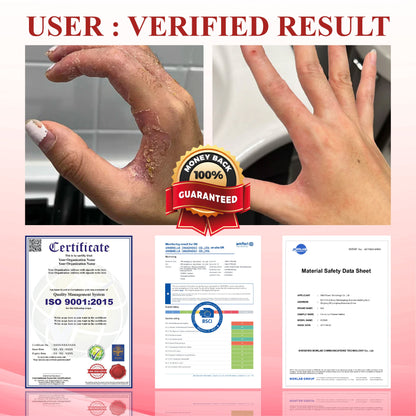 ODEIUN® GlucoseGuard Skin Rescue Cream