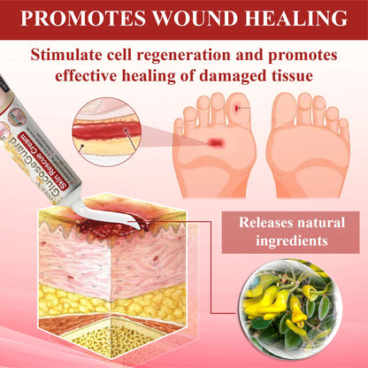 ODEIUN® GlucoseGuard Skin Rescue Cream