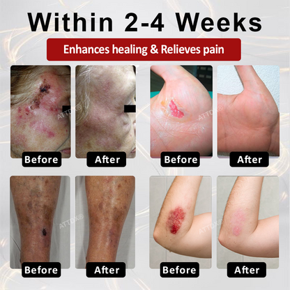 ODEIUN® GlucoseGuard Skin Rescue Cream