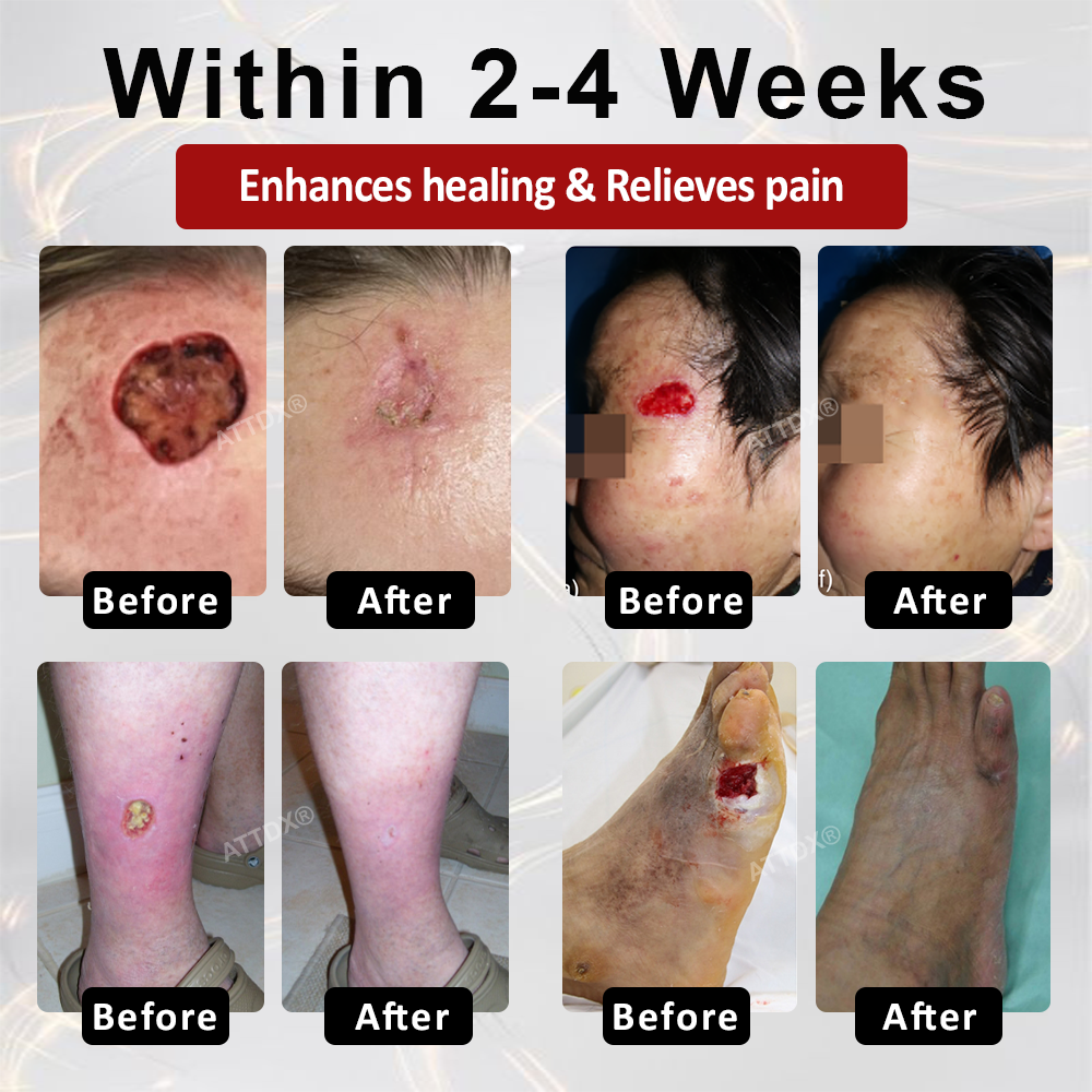 ODEIUN® GlucoseGuard Skin Rescue Cream