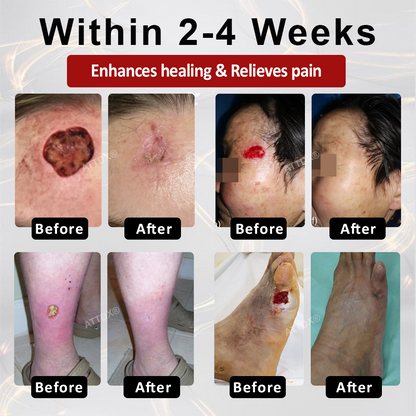 ODEIUN® GlucoseGuard Skin Rescue Cream