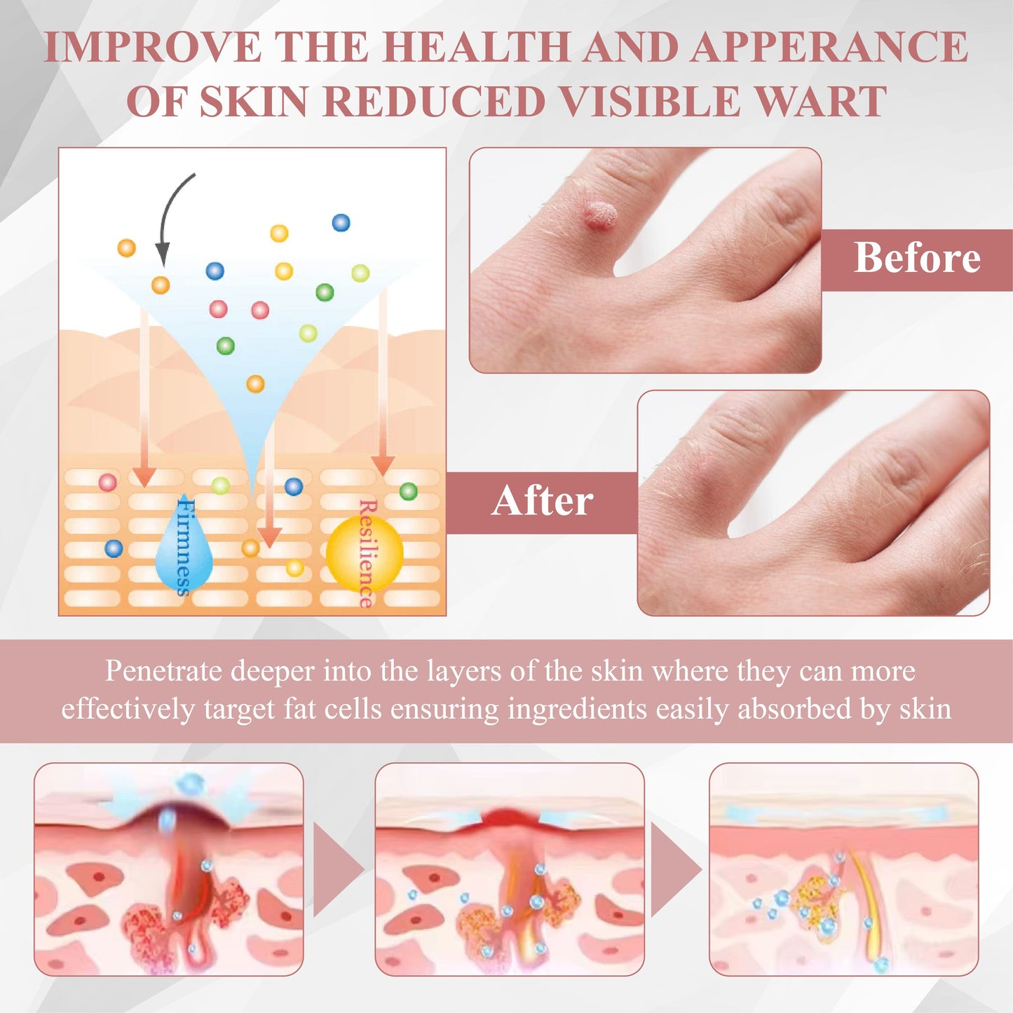 ODEIUN® Wart & Spot Removal Peel-Off Gel Wrapping Mask