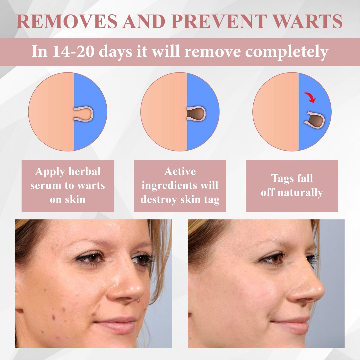 ODEIUN® Wart & Spot Removal Peel-Off Gel Wrapping Mask