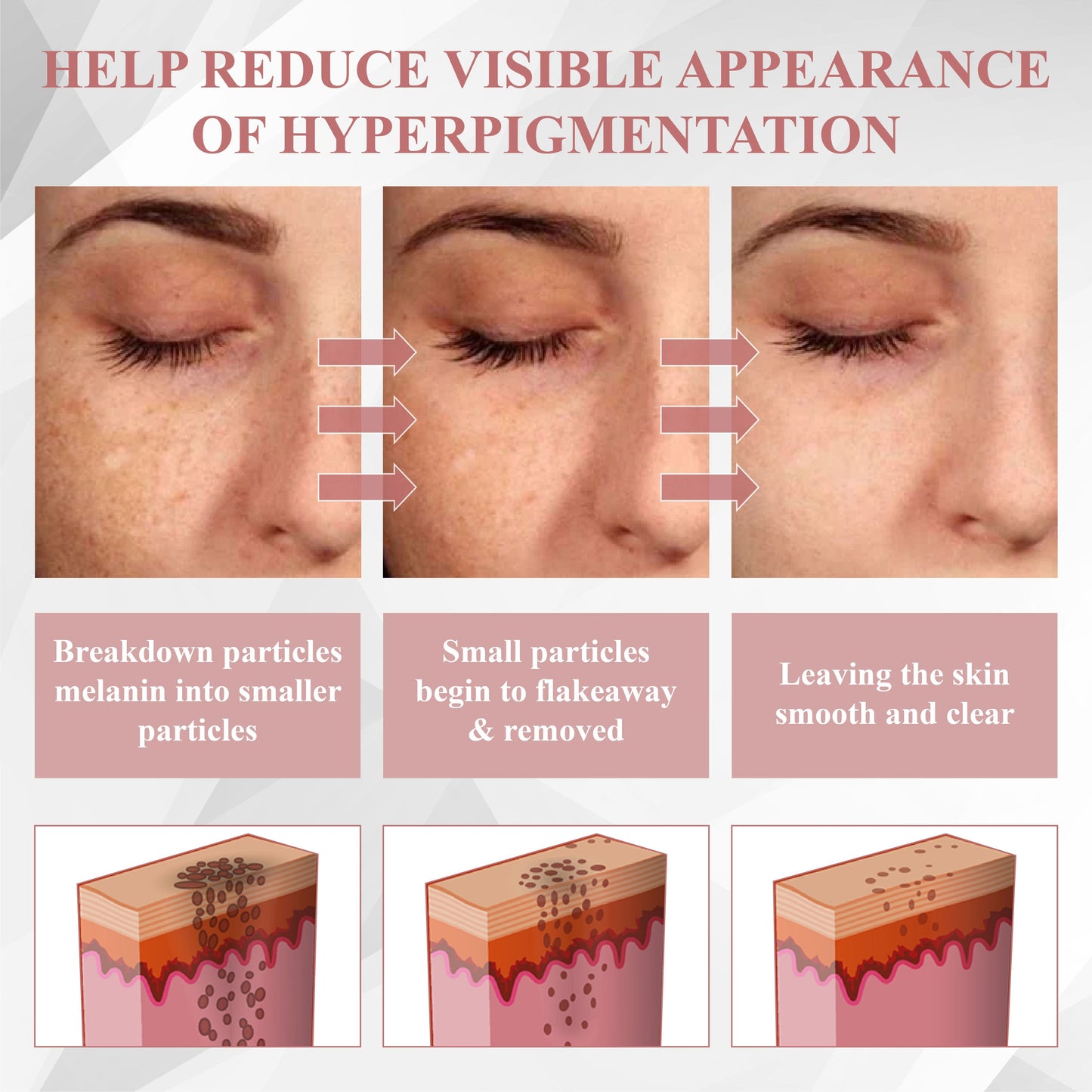 ODEIUN® Wart & Spot Removal Peel-Off Gel Wrapping Mask