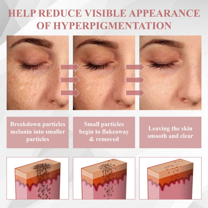 ODEIUN® Wart & Spot Removal Peel-Off Gel Wrapping Mask