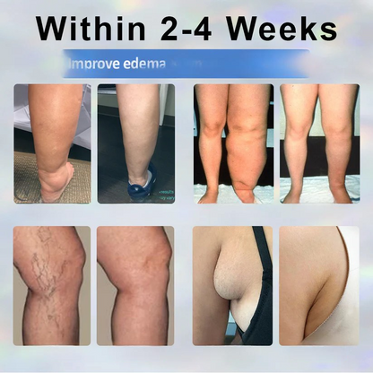 ODEIUN® Black Cumin Edema Detox Herbal Cream