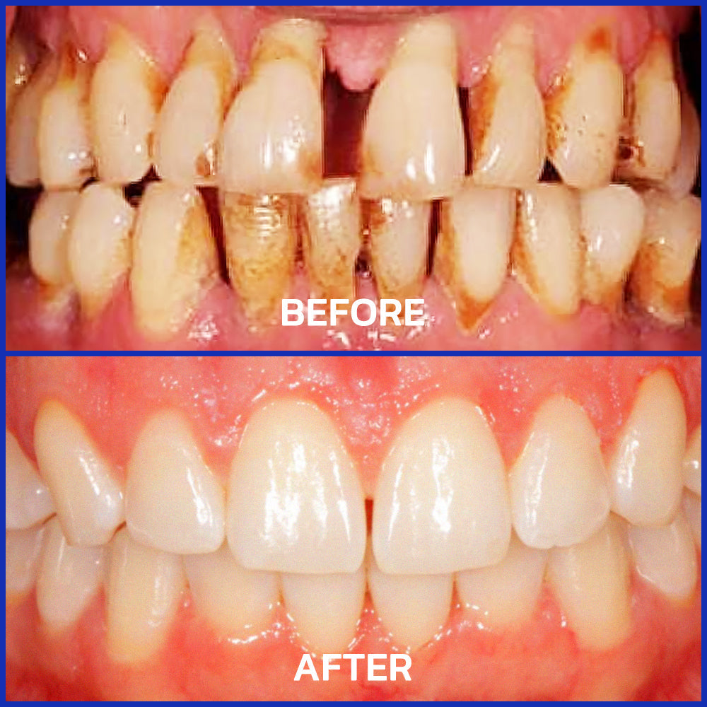 Cougex® VioGloss Bee Venom Dental Therapy Oral Power