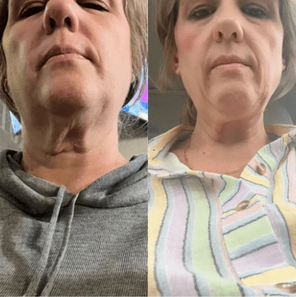 🔥Last Day 70% OFF🔥-ODEIUN™ Tighten & Lift Neck Cream