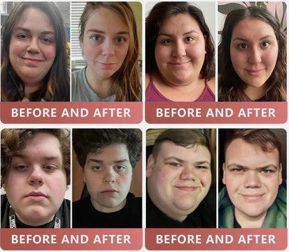 💥2025 NEW GLP-1 Metabolic Balance Patches-(1 SET/30)