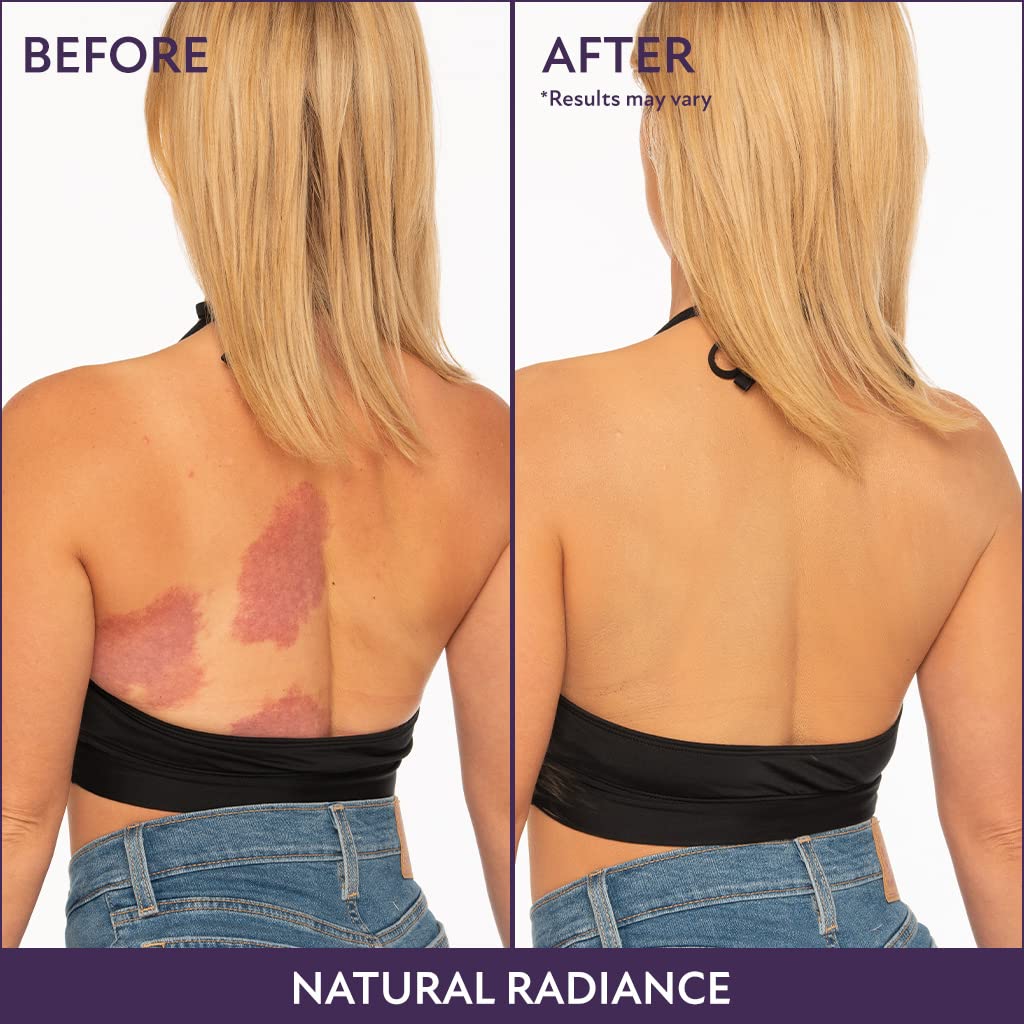 Body Coverage Perfector – All-in-one moisturizer, concealer & coverage 💧✨ Lightweight & waterproof