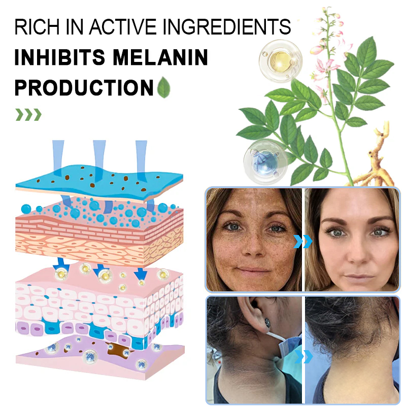 ODEIUN™ Purifying Exfoliating Gel for Acanthosis Nigricans, Exfoliation, Dark Spots, Skin Tags, and Eczema