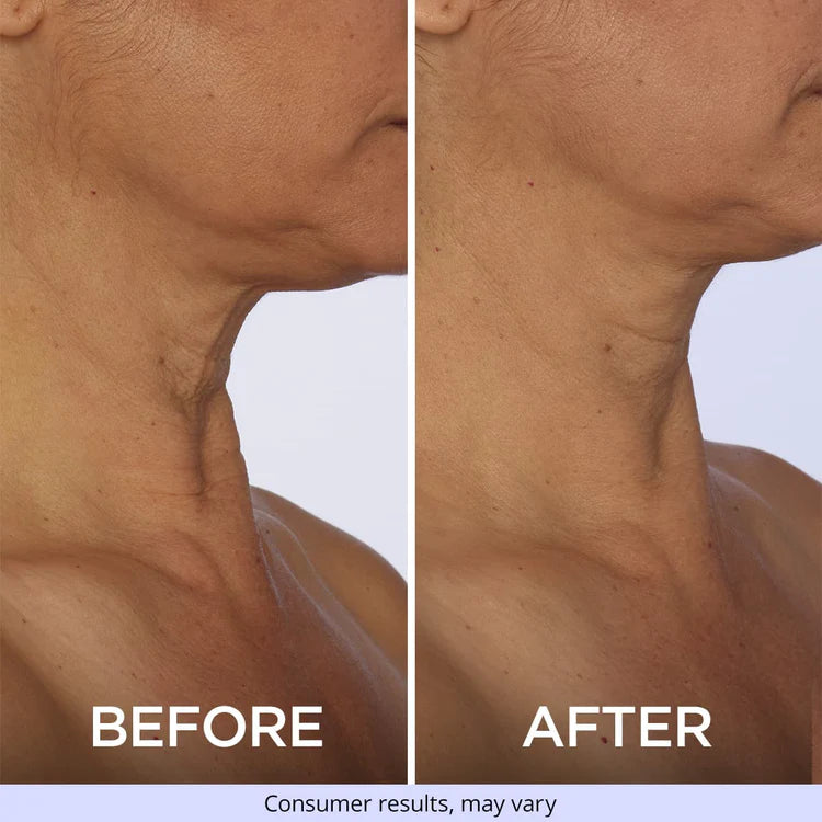 🔥Last Day 70% OFF🔥-ODEIUN™ Tighten & Lift Neck Cream