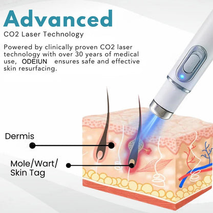 🔥【OFFICIAL STORE】ODEIUN™ Non-Invasive Mole and Wart Removal Laser Pen