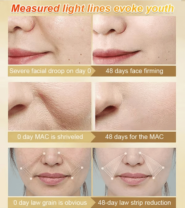 🔥LAST DAY 49% OFF✨Anti-wrinkle firming serum✨