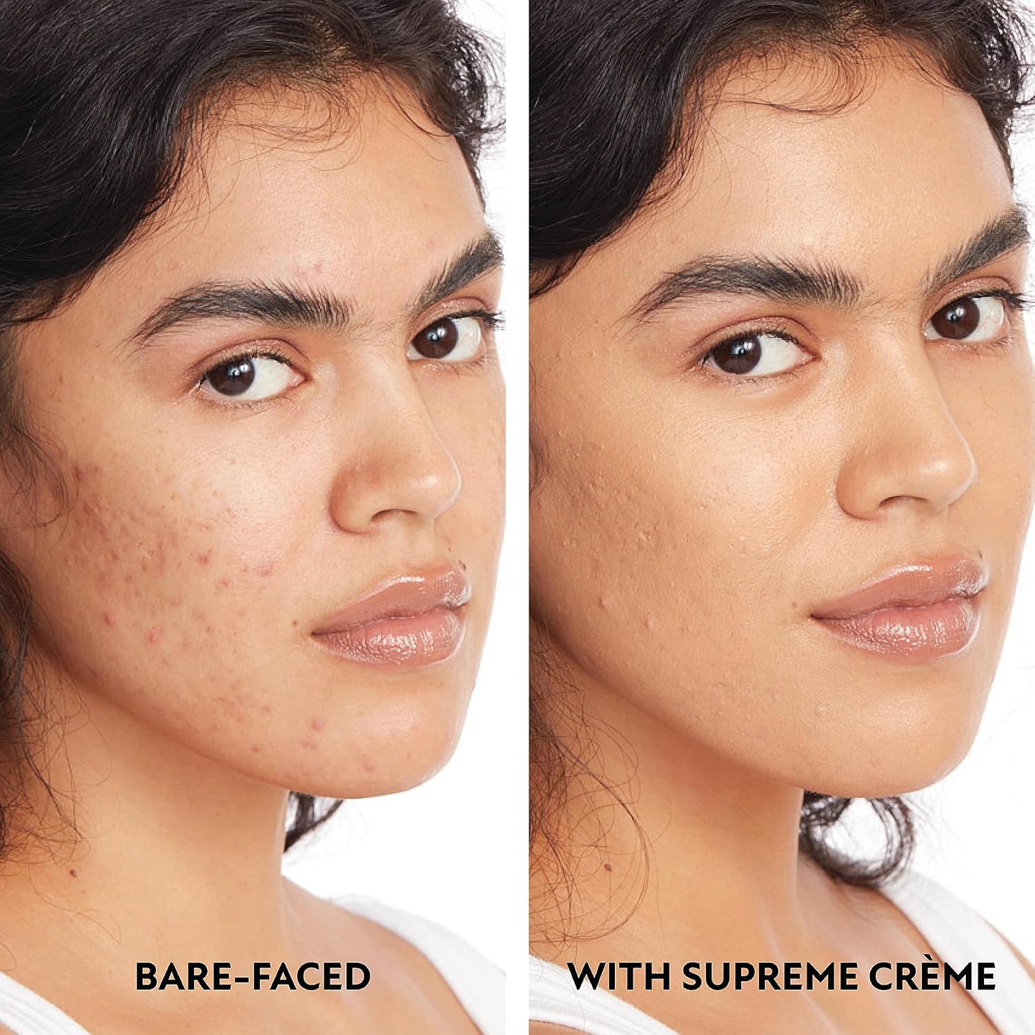 Body Coverage Perfector – All-in-one moisturizer, concealer & coverage 💧✨ Lightweight & waterproof