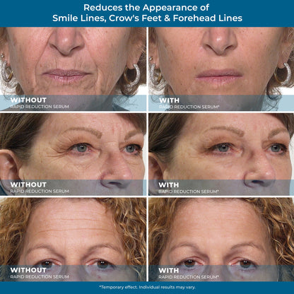 🌟 Prexdren®  Rapid Reduction Eye Serum — Instantly reduces eye bags, wrinkles, and dark circles