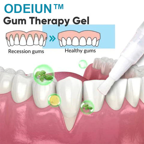 （🔥LAST DAY SALE-80% OFF) ODEIUN™ Gum Therapy Gel