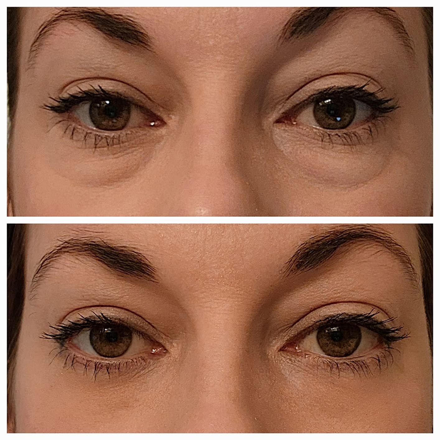 🔥Last Day 49% OFF🔥 Instant Eye Lift Firming Cream💕
