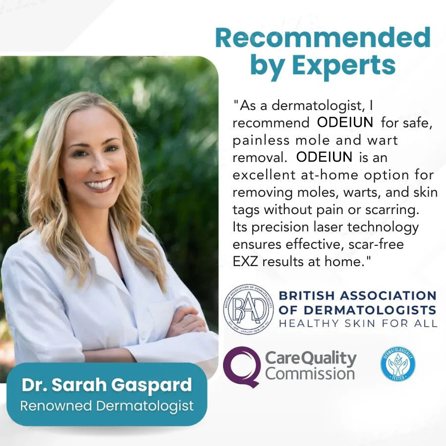 🔥【OFFICIAL STORE】ODEIUN™ Non-Invasive Mole and Wart Removal Laser Pen