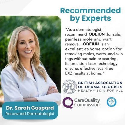 🔥【OFFICIAL STORE】ODEIUN™ Non-Invasive Mole and Wart Removal Laser Pen