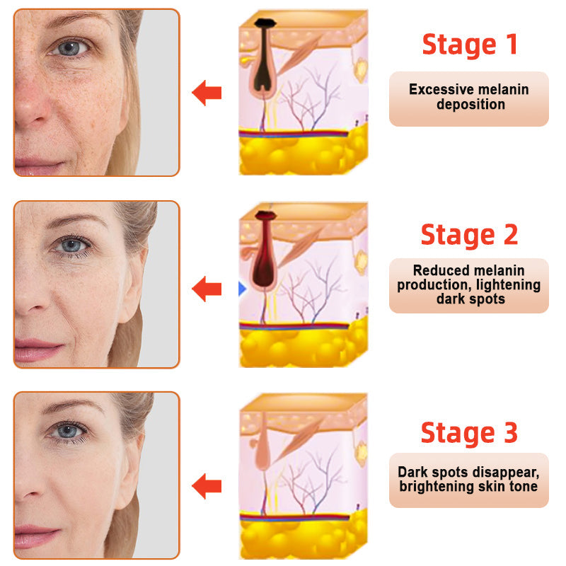 ODEIUN™ Purifying Exfoliating Gel for Acanthosis Nigricans, Exfoliation, Dark Spots, Skin Tags, and Eczema